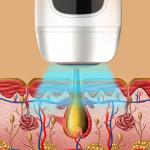 Freezing Point Laser IPL Hair Removal Epilator 990000 Flashes Home Use Portable