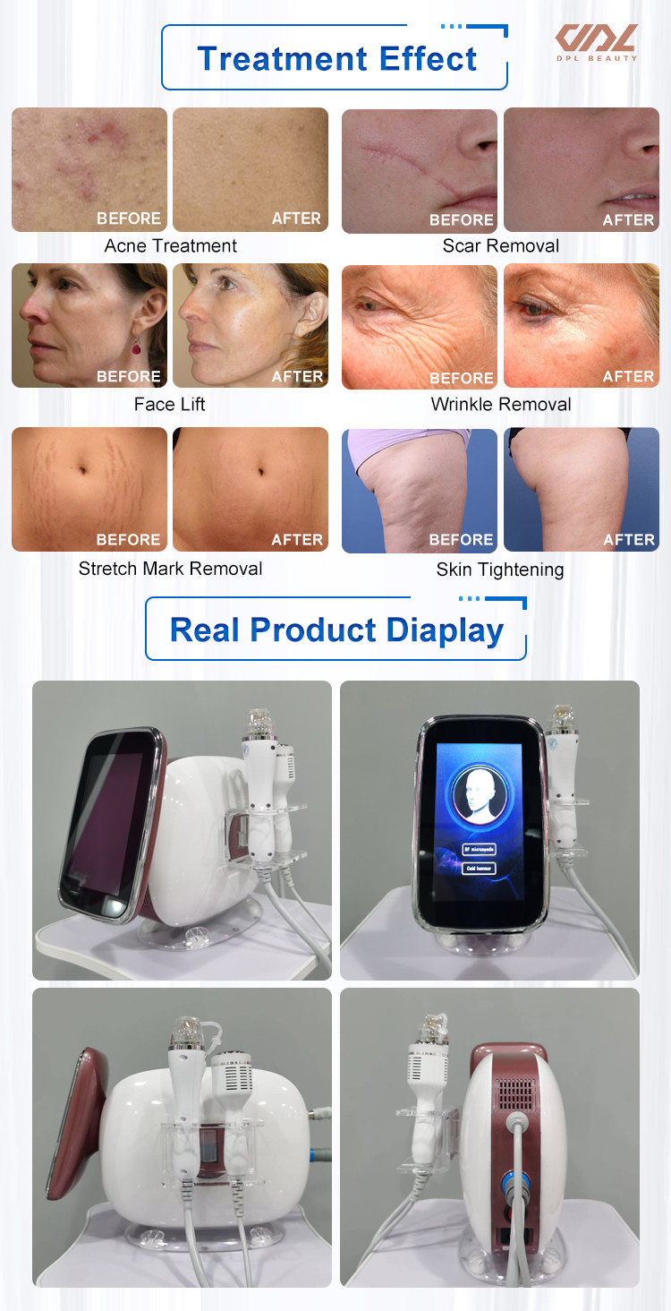 MJ0002 200w Multifunction 2 In 1 Insulated Needle With RF Miconeedle Portable Facial Skin Tightening RF output
