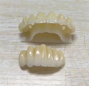 Quality Precision Zirconia Multilayer Product For Improving Fracture Resistance wholesale