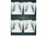 20cm x 25cm Medical Diagnostic Imaging , Laser Printer Film X Ray Paper