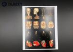 0.15mm Medical Radiation Printing Film