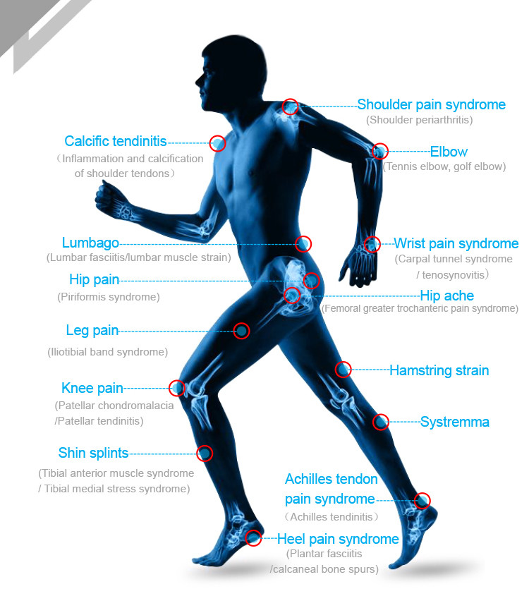 Focused Shockwave Therapy Machine Focus Shock Wave Machine Physiotherapy Pain Relief Machine
