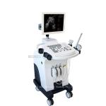 2D Clinic Trolley Medical Diagnosis Equipment Ultrasound Scanner