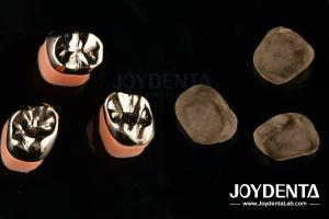 Quality Dental Restoration Gold Metal Crowns for Oral Rehabilitation Treatment wholesale