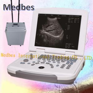 Quality 2D pORTABLE Ultrasound Scanner with High Quality wholesale