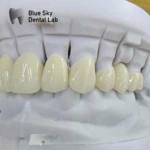 China Translucent Layered Zirconia Crown Dental Restoration Multilayer Zirconia Crown on sale