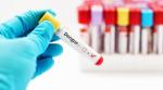 CE Approved Dengue Ns1 Antigen Test Kit Antibody Rapid Test Cassette