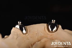 Quality Joydental dental lab Ball Attachment wholesale