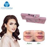 Hyaluronic Acid Filler Hyaluronic Acid Injection Gel Filler For Lip Cheek And