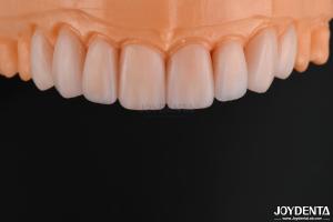 Quality Customizable Glass Ceramic Veneer Natural Looking High Chemical Resistance wholesale