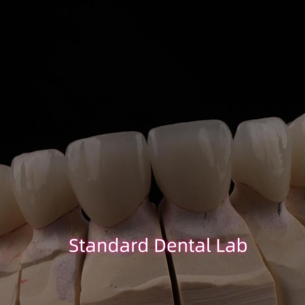 Cheap PFZ Dental Layered Ceramic Zirconia Bridge With Incisal Translucent for sale