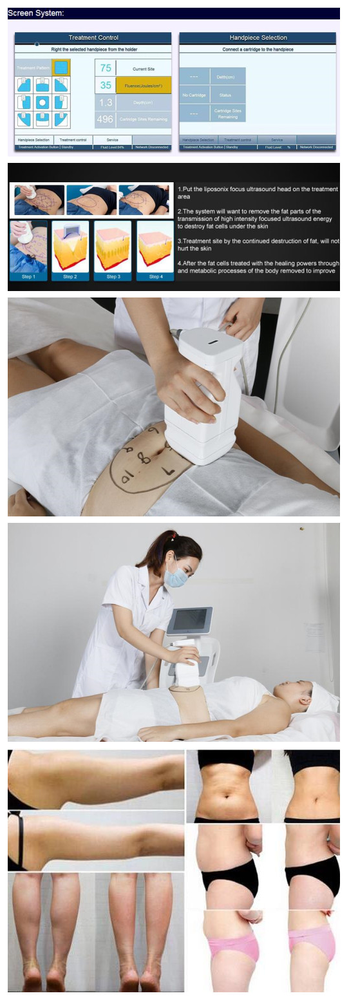 New design lipo laser for lifting machine with great price