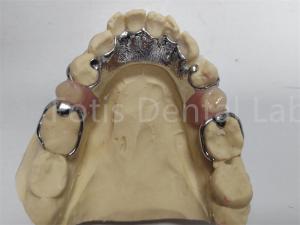 Quality Adjustable Co Cr Partial Denture Comfortable Dental Prosthesis For Missing Teeth wholesale