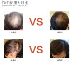 hair treatment Hair Growth Essence anti hair Loss Liquid dense unix hair