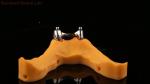 Ivoclar Digital Dental Implant Bar Denture with Attachments , Full Acrylic