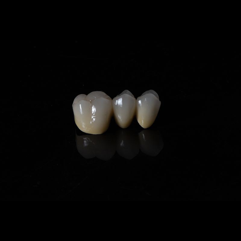 Anti Wear Implant PFM Dental Bridge Prosthesis Teeth Replacement