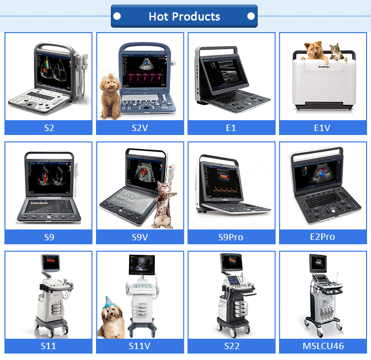 Sonoscape S8 B/ 2B/ 4B/ M/CW Echocardiography Ecograph 4D Laptop Notebook Portable Color Doppler