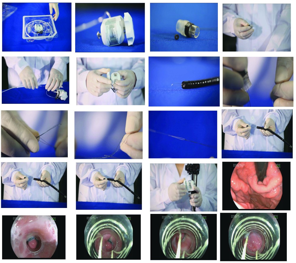 surgical instrument Band Ligation
