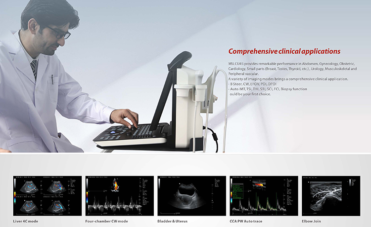 Portable Full Digital Color Doppler Ultrasound System Medical Scanner Ultrasound