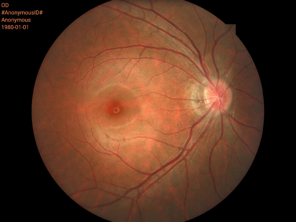 Portable Digital Fundus Camera with Ce Approval (HA06)