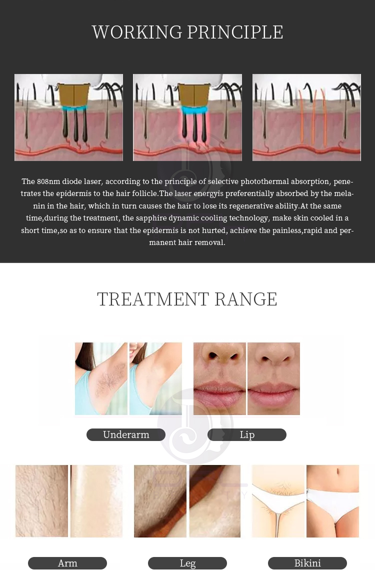 laser beauty equipment Painless 808nm Lazer Hair Removal Diode Laser 755 808 1064 Hair Removal Machine