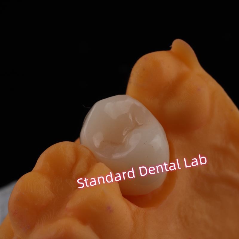 Full Contour Zirconia Crown Exceptional Strength and Esthetics No Porcelian Overlay Posterior Crown China Dental Lab