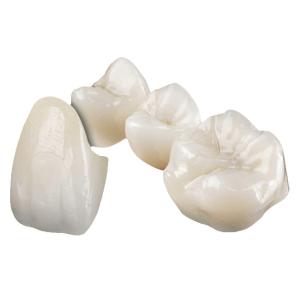 Quality Aesthetically Stable Zirconia Ceramic Crown Non Irritating Implant Crown wholesale