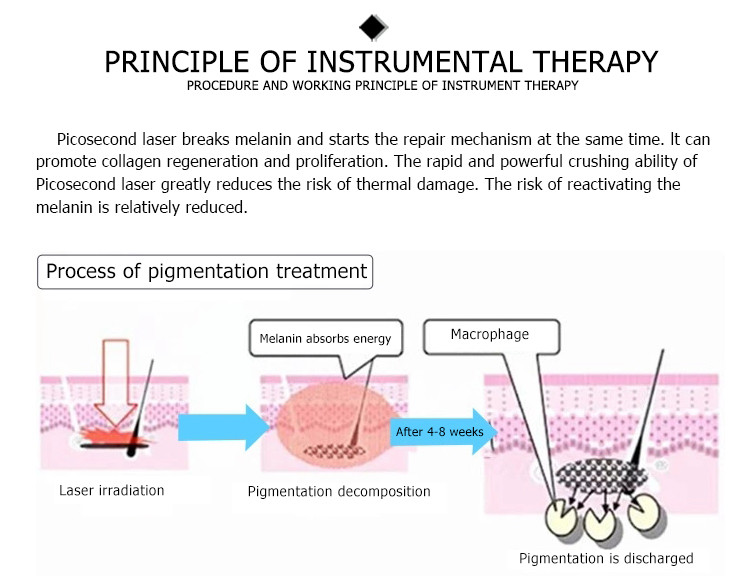 hottest pigmentation removal machine neat cell aesthetic shanghai tattoo remover Pico second Laser