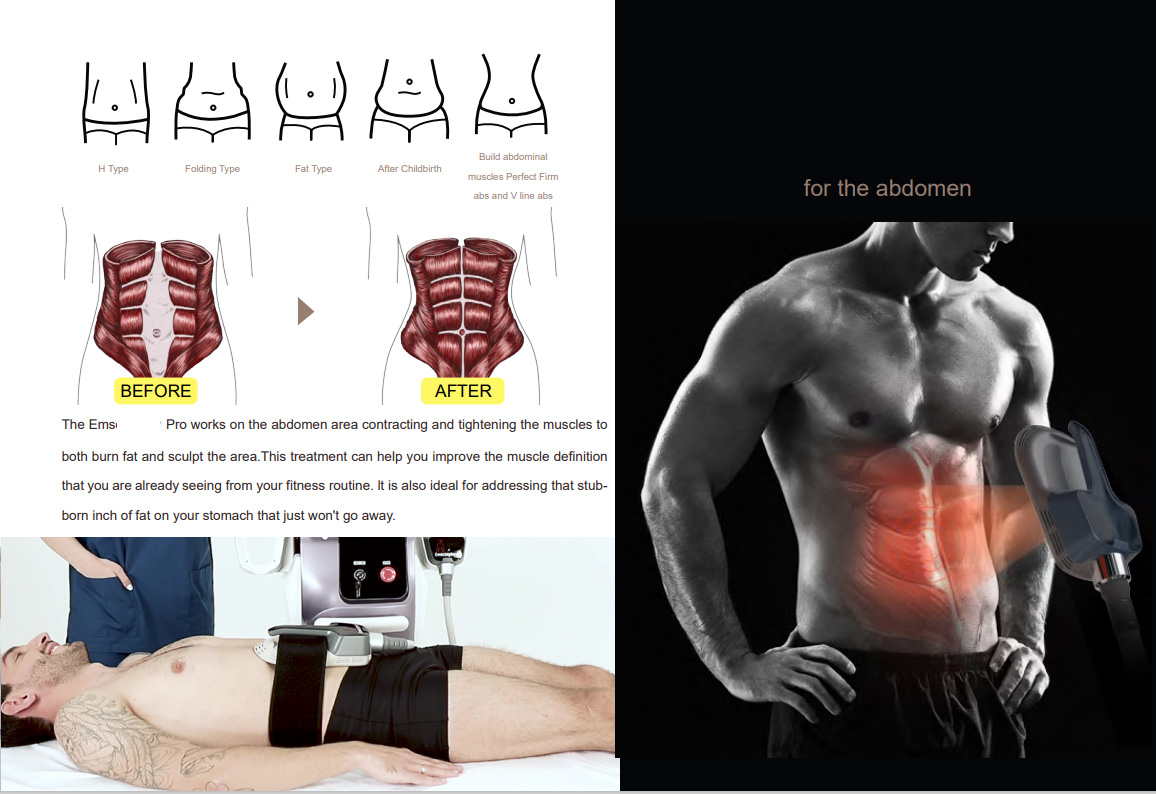 Four handles Commercial EMS Slimming Machine 150HZ For Weight Loss