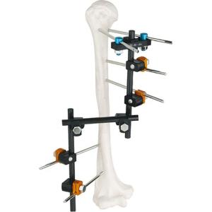 Quality Condylar External Fixation Device wholesale