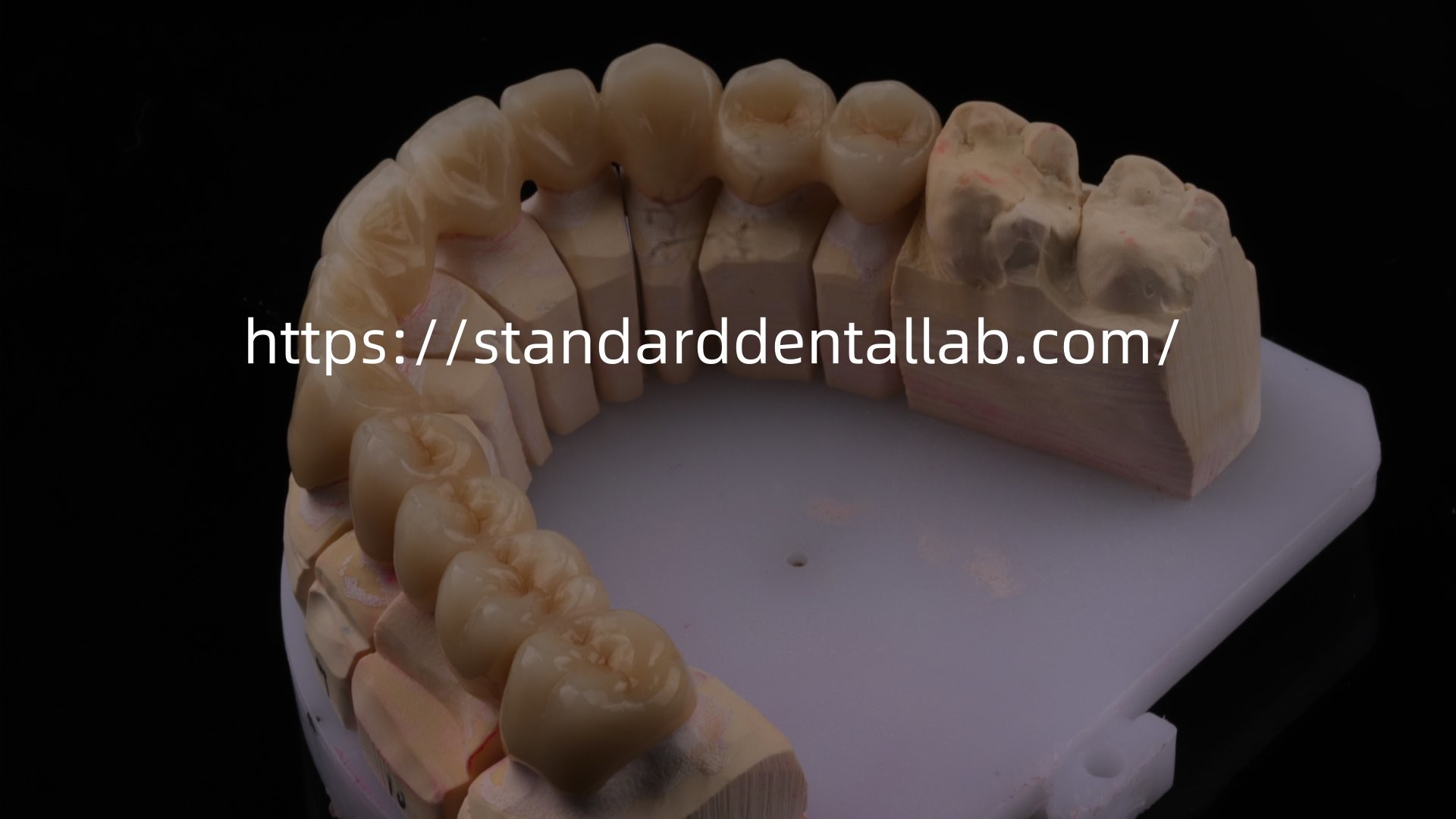 Highly Durable And Natural-Looking Layered Porcelain For Layered Dental Zirconia Crown China Dental Lab