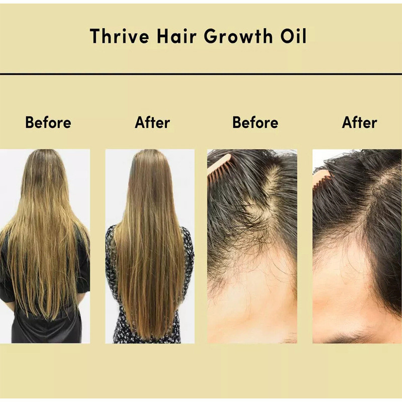 Custom Natural Hair Care Serum Treatment Ginger Hair Oil For Anti Loss Promoting Hair Regrowth Regeneracion Del Cabe