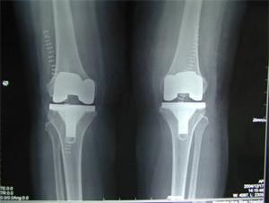 Quality 14*17inch agfa high quality Dry Digital X ray Film wholesale
