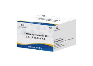 Quality CK-18 Keratin RUO Test Kit Human Cytokeratin 18 ELISA Kit wholesale