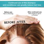Biotin Hair Growth Shampoo Conditioner Set Thickening Anti Hair Loss Shampoo