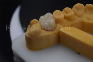 Quality Titanium / PFM Denture Crown Customizable Zirconia Implant Crown Durable wholesale