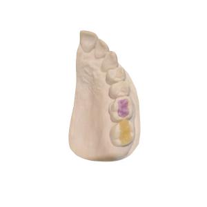 Quality Custom High-Density Custom Dental Ceramics FDA All-Ceramic Crown wholesale