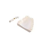 Customized PFM Porcelain Dental Crown Full Metal Corrosion Resistance