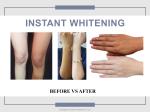 OEM Hotel Body Lotion Instant Whitening Lightening Tube