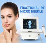 Face Lifting Portable Rf Fractional Microneedling Machine For Acne Scar Removal