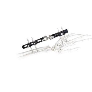 Quality Orthopedic Surgical External Fixation Device Wrist wholesale