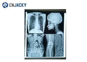 Quality Hospital Examination CT 14 &quot; X 17 &quot; Medical Radiation Printing Film wholesale