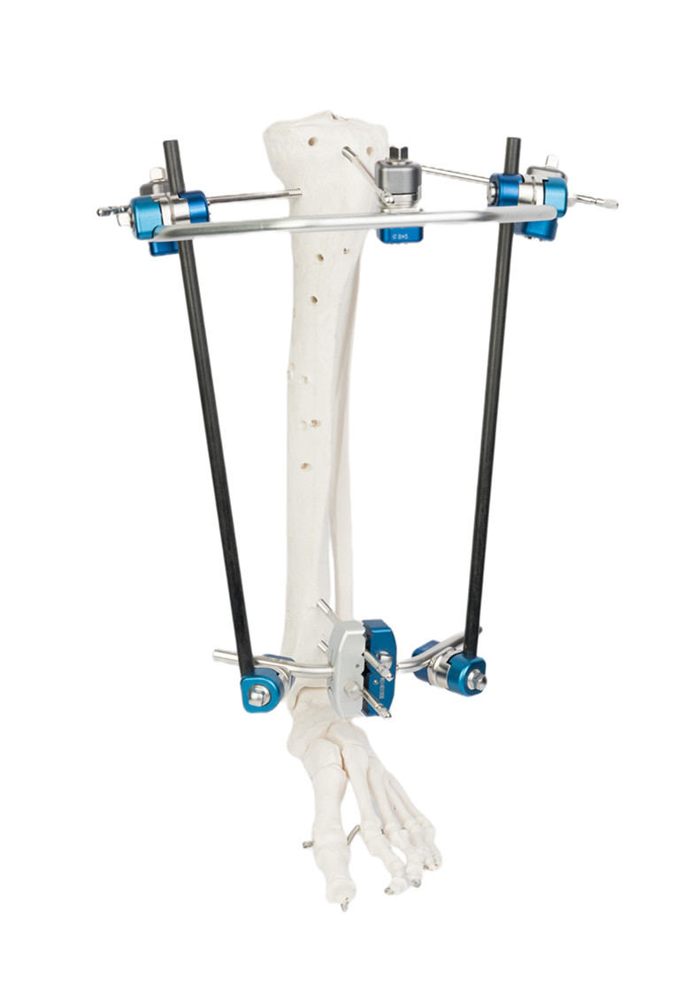 SS Blue Ortho External Fixator Cross Clamp Class I Class III