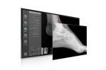 Medical Infrared Rugged Display Monitors Waterproof Infrared Touch Screen