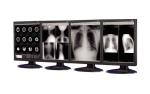 Anti-reflective Medical Grade Displays used in medical imaging equipment