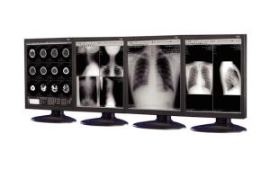 Quality Anti-reflective Medical Grade Displays used in medical imaging equipment wholesale