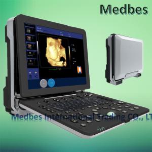Quality Hospital 4D Fetal doppler Ultrasound Scanner wholesale