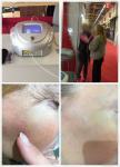 Portable Pulser Laser Therapy Equipment , 980nm Spider Vein Removal Machine