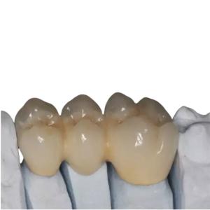Quality OEM Customized Zirconia Porcelain Teeth High Strength Durable Beautiful wholesale