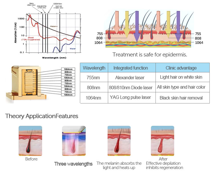 diode hair removal 3 Wavelength Diode Laser Hair Removal System 755nm 808nm 1064nm Beauty Care Device